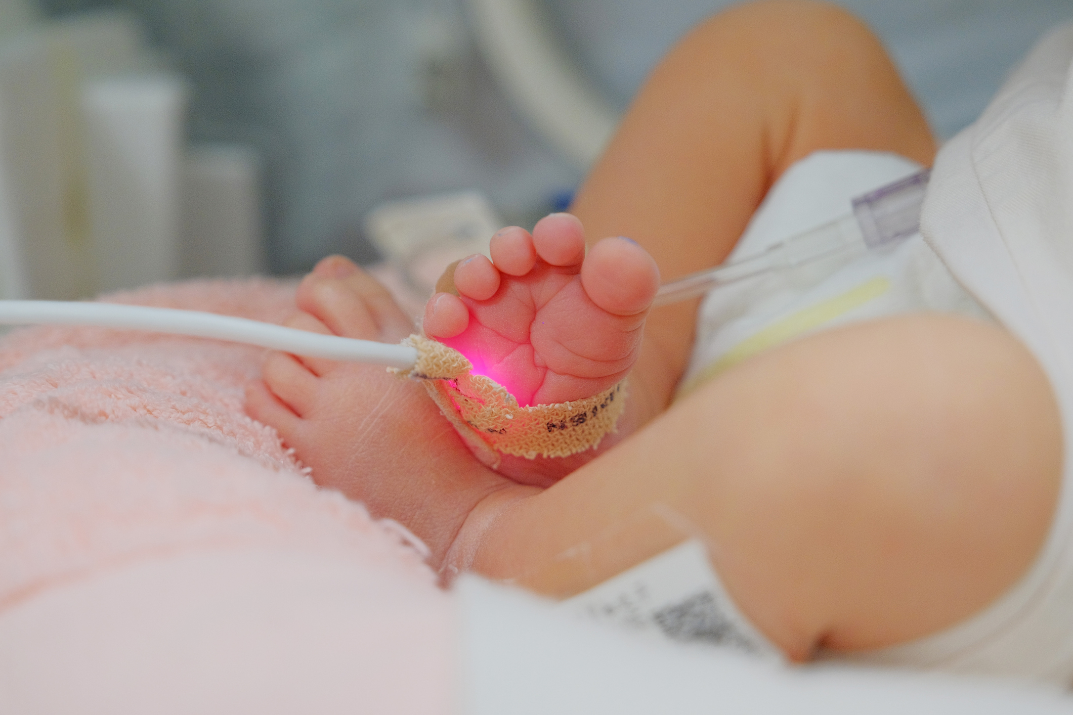 January is Tracheoesophageal Fistula/Esophageal Atresia (TEF/EA) Awareness Month